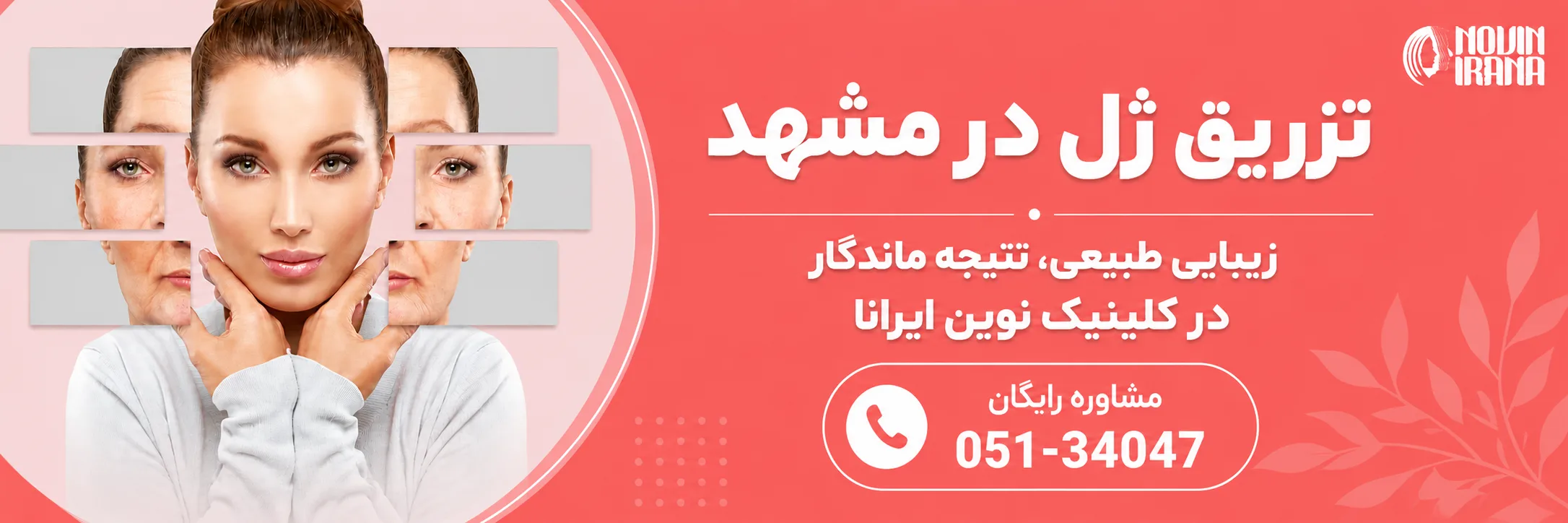 تزریق ژل در نوین ایرانا